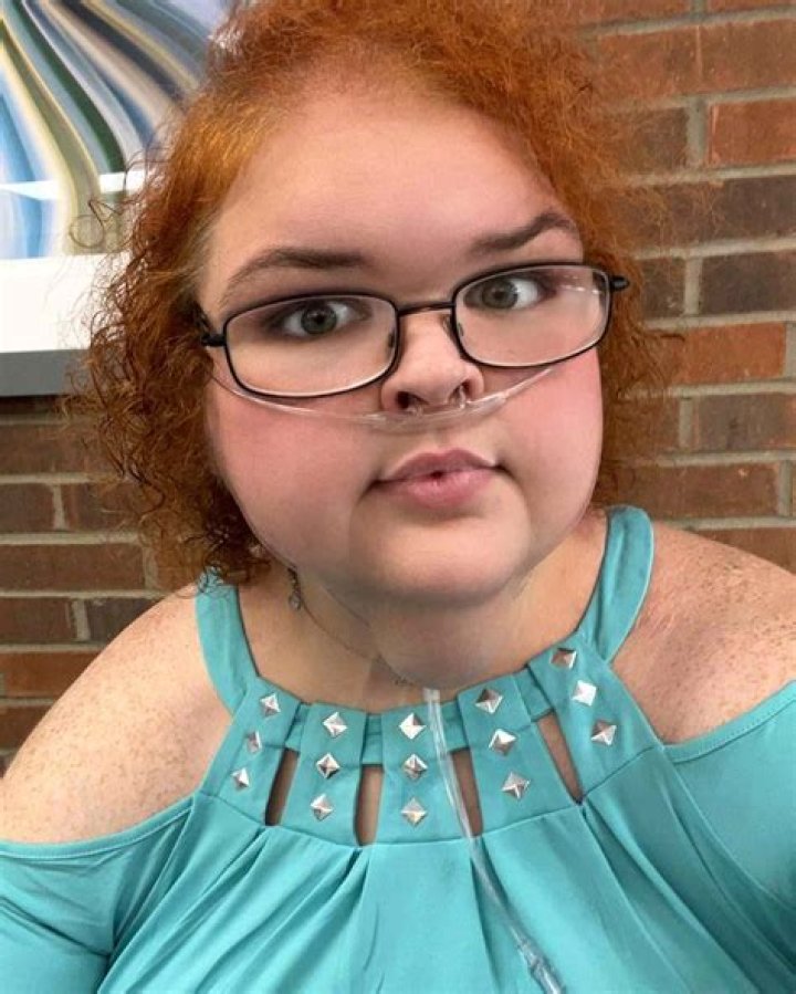 A Journey Of Transformation: A For Adley Mom Weight Loss Surgery